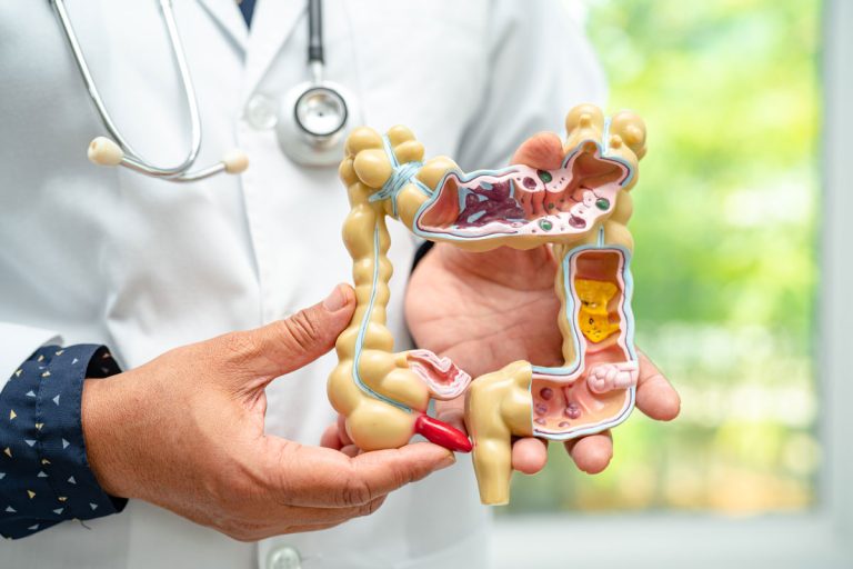 doctor sostiendo modelo del sistema digestivo humano